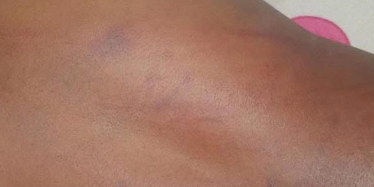 Labé : une fillette de 11 ans victime de violences corporelles pour un vol présumé de 100 000 GNF